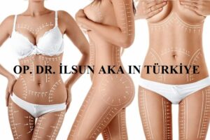 Mommy Makeover Turkiye 300x200